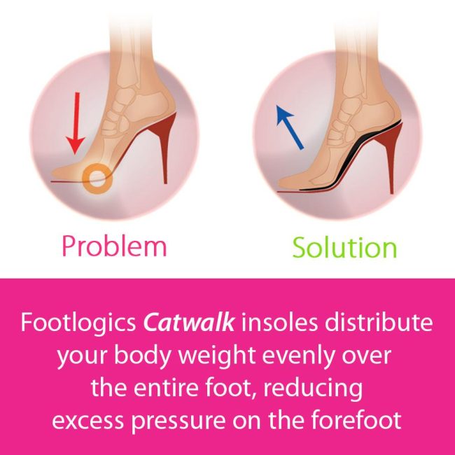 Footlogics Catwalk