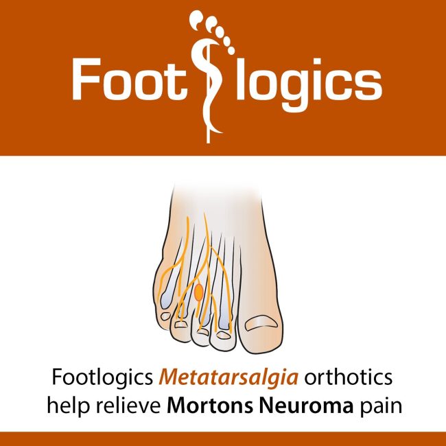 Footlogics Metatarsalgia